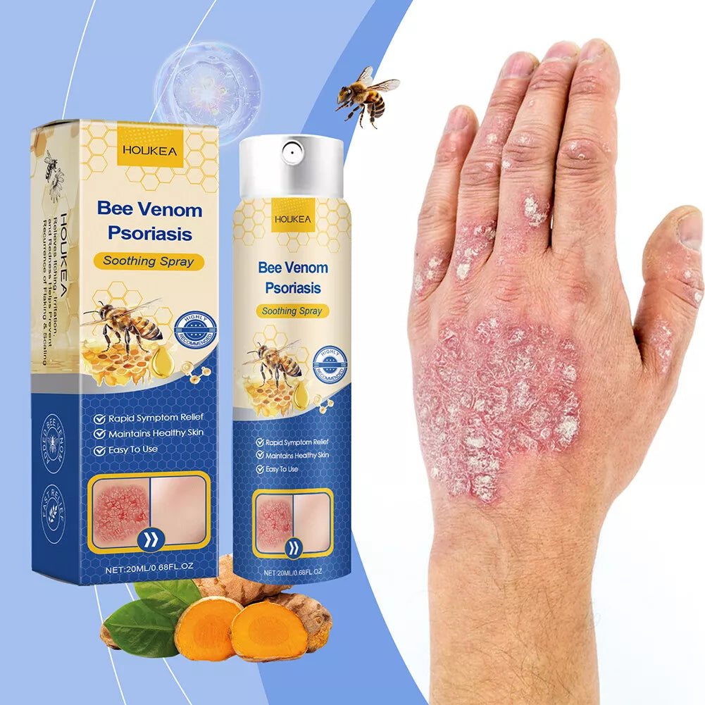 Bee Venom Psoriasis Soothing Spray